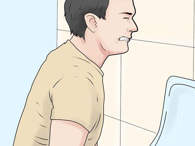 Urinarea dureroasă este un simptom al exacerbarii prostatitei la bărbați