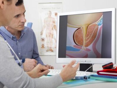 Un urolog consultă pacientul despre prostatita și metodele de tratament.